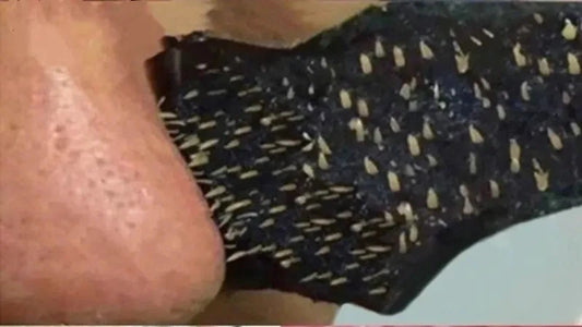 Blackhead Removal Nose Mask - 5/10/15/20 Pieces